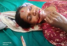 शेतात काम करणाऱ्या महिलेवर बिबट्याचा हल्ला ; महिलेचे मुंडके जबड्यात पकडल्याने झाल्या गंभीर जखमा।.